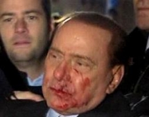 Berlusconi goditet me shufër hekuri ne fëtyrë